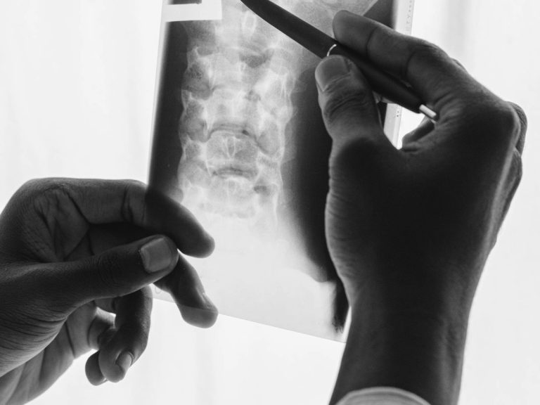 Mains examinant une radiographie à l'aide d'un stylo